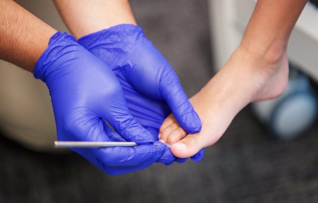 treating an ingrown toenail