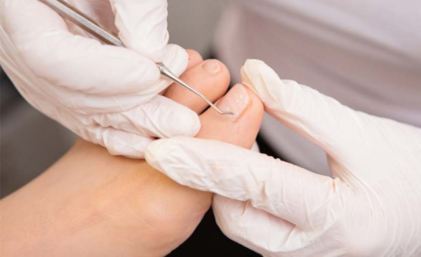 using podiatry tool to check toe nails